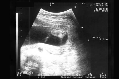 122-21.1.2005.jpg