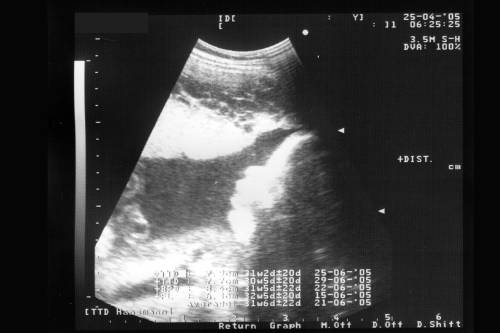 132-25.4.2005.jpg